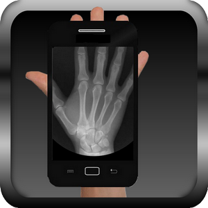 Scanner Xray Prank