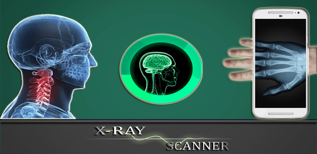 Xray Scanner (Prank)